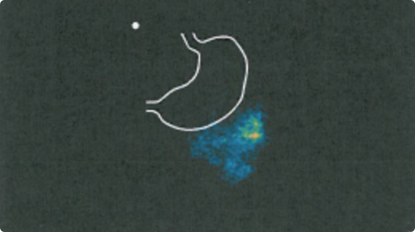 DRcaps capsule has left the stomach and releases its contents in the intestine.